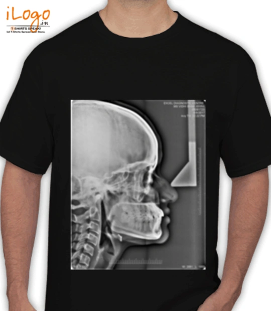 T shirts xray T-Shirt